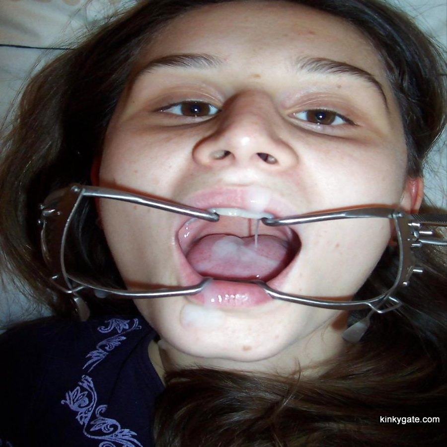 Amateur Braces Porn